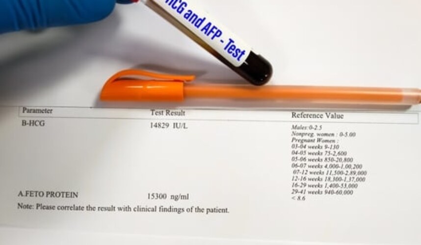 Beta HCG Nedir? Haftalara Göre Değerleri