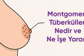 Montgomery Bezleri Nedir?