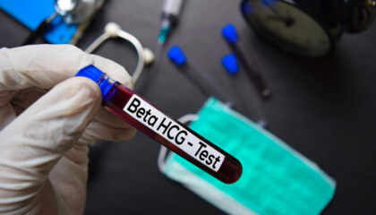 Beta HCG sonucum 0.100 çıktı, acaba hamile olabilir miyim?